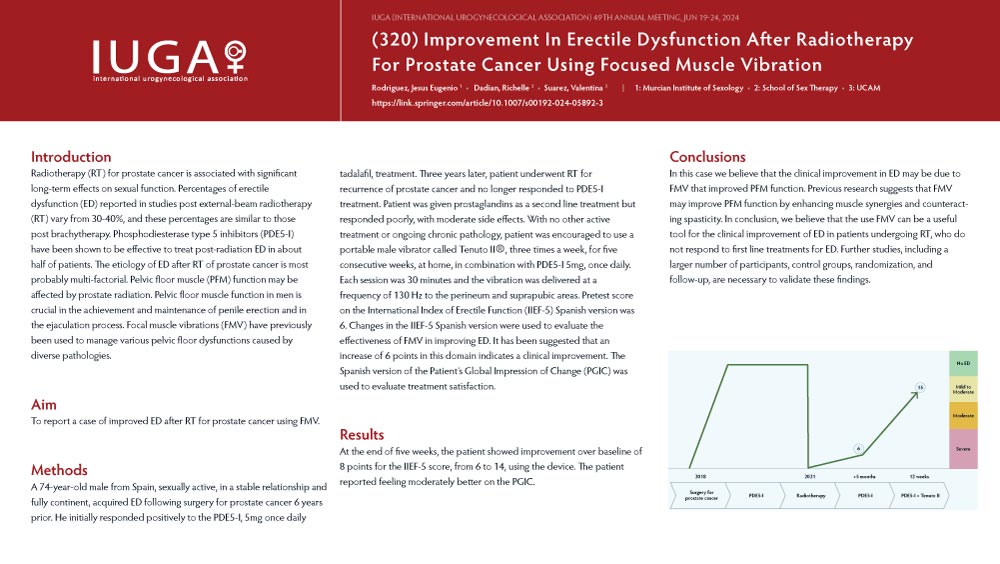 Improvement in Erectile Dysfunction After Radiotherapy for Prostate Cancer Using Focused Muscle Vibration (FMV)